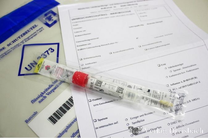 Ein Abstrich-Set, wie es für Corona-Tests verwendet wird.